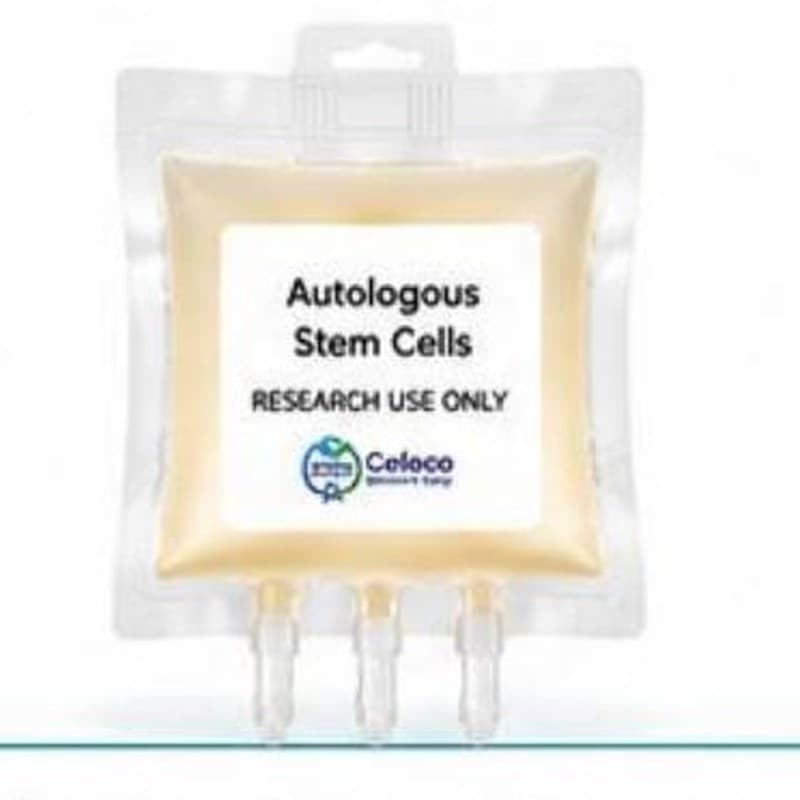 Autologous Stem Cells